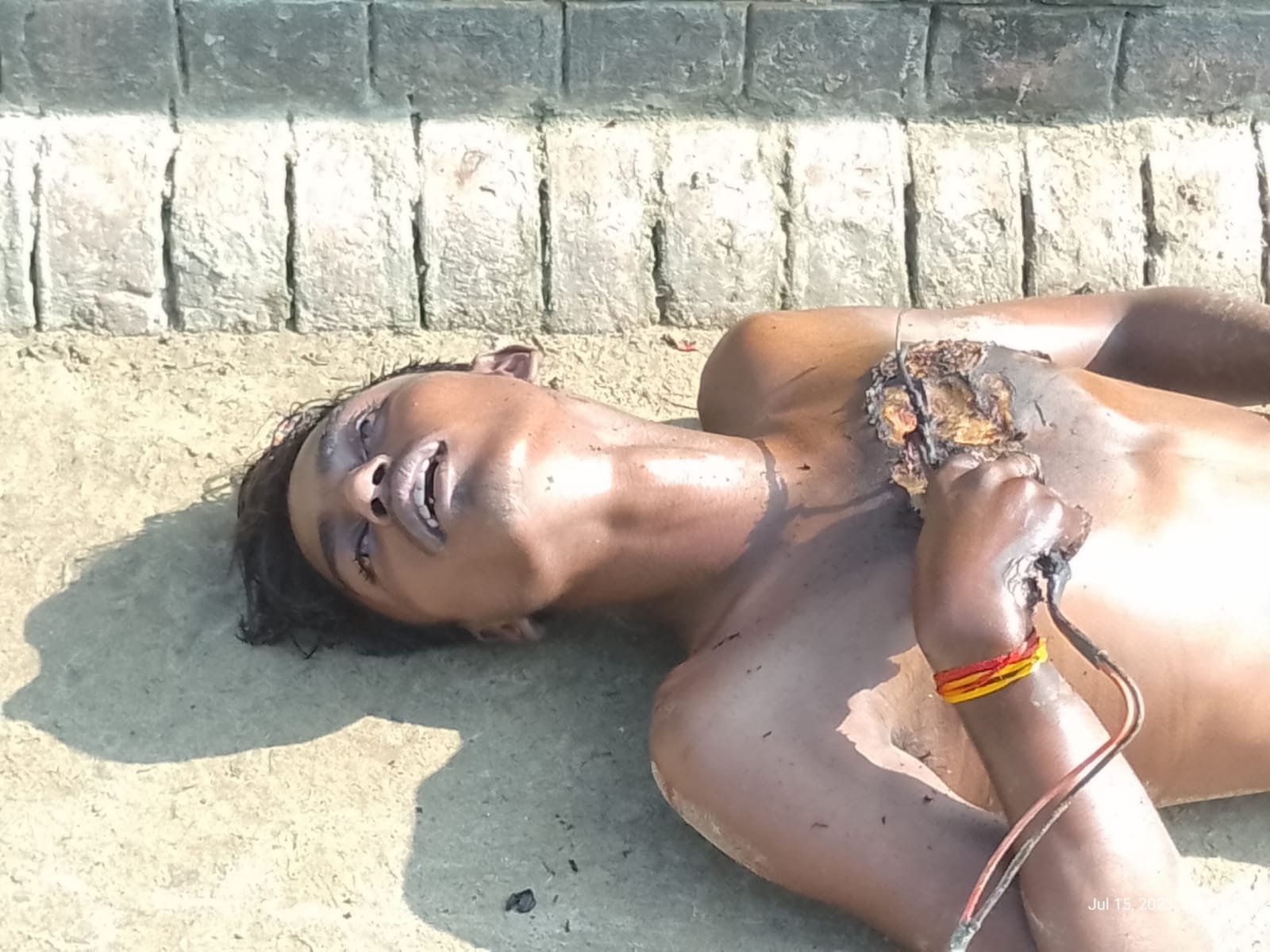 नहर में नहाते समय विद्युत तार की चपेट में आने से 19वर्षीय बालक की हुई मौत