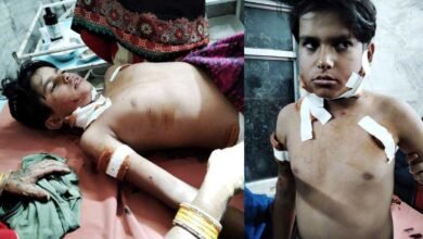 मां ने दिखाई हिम्मत, डंडे से किया प्रहार तो भागा तेंदुआ