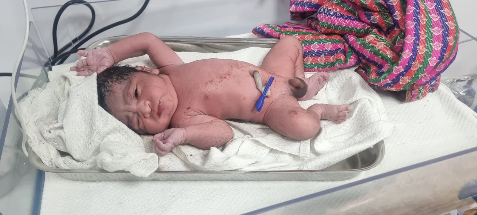 महाकुम्भ मेला क्षेत्र के परेड में स्थित अस्थाई अस्पताल में महिला ने दिया बालक को जन्म