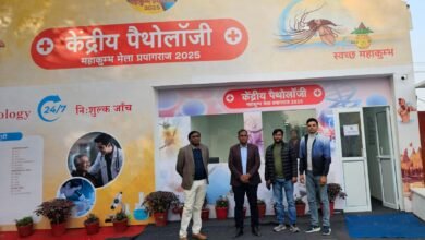 सीएम योगी के निर्देश पर मरीजों को मिलने लगीं अत्याधुनिक सुविधाएं, रोज 800 से 900 मरीजों का हो रहा इलाज