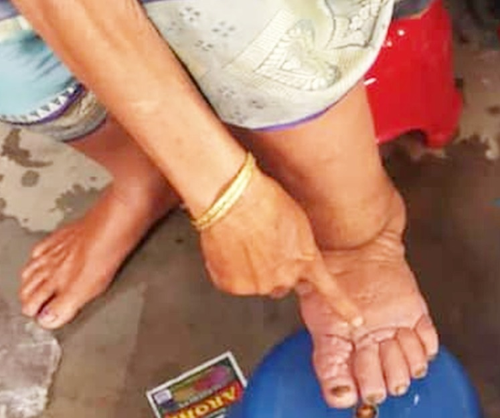 #FilariaFreeUttarPradesh, #MDACampaign, #CMYogiAdityanath,#HealthAwareness, #RuralAwareness, #FilariaElimination